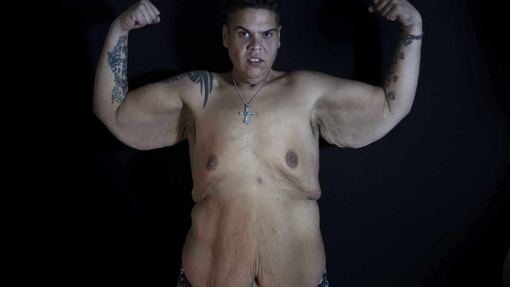 Juan Manuel Heredia llegó a pesar 307 kilos, lo que lo convirtió en la persona más obesa de España.