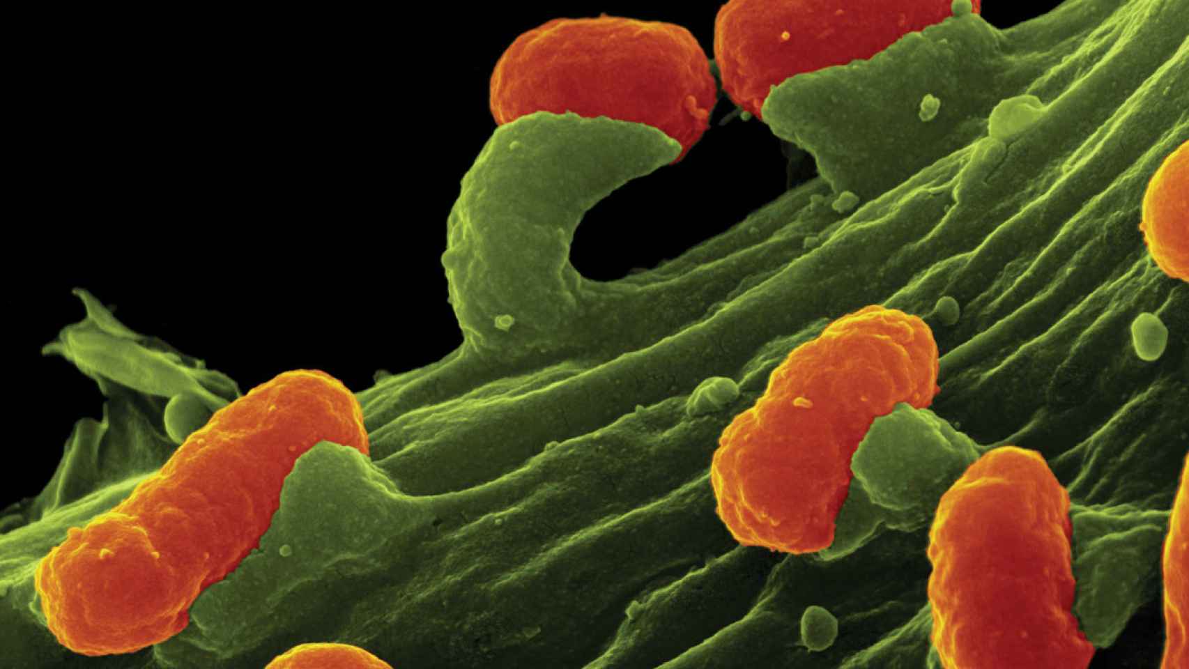 Imagen al microscopio de la bacteria E. colli