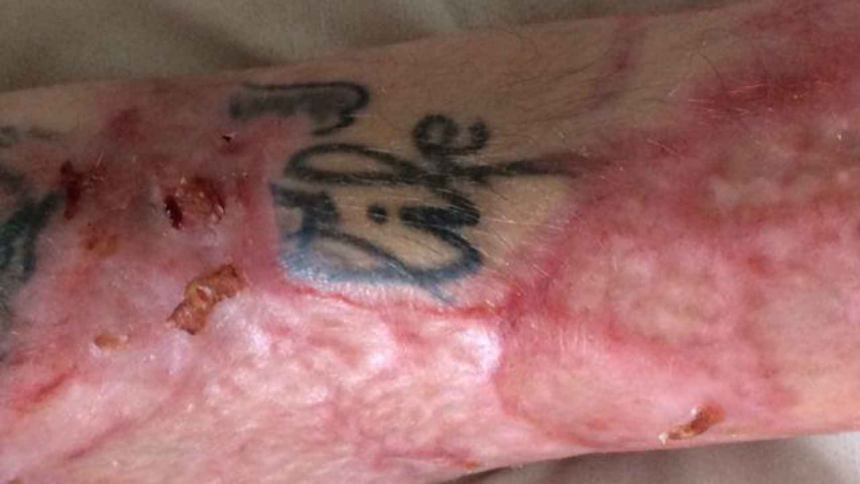 El único tatuaje que conserva Franck lleva escrito: Life (vida)