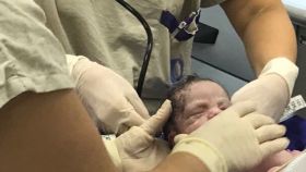 El bebé gestado en el útero de una mujer fallecida.