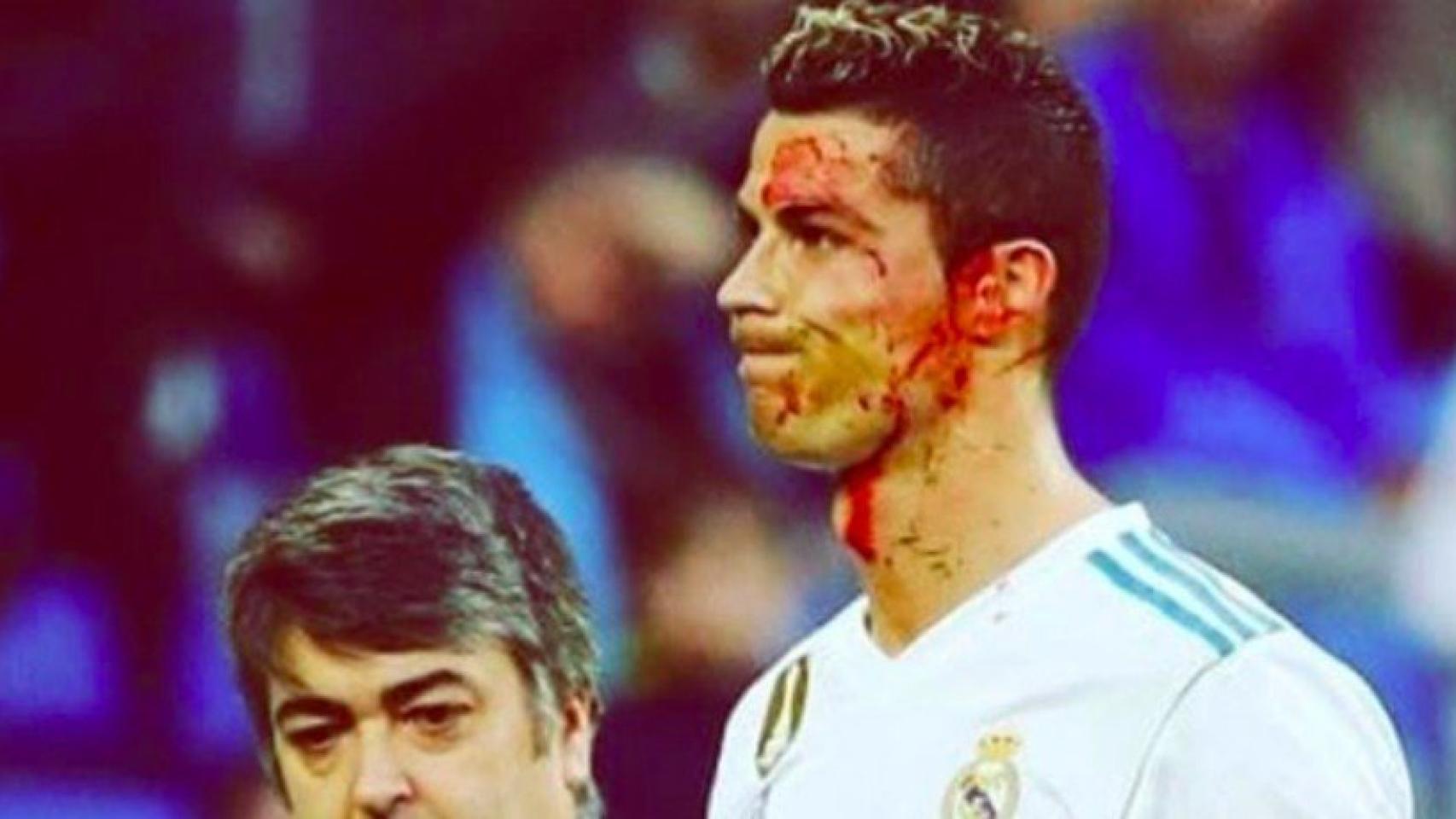 Cristiano con el rostro ensangrentado. Foto Instagram (@katiaaveiro)