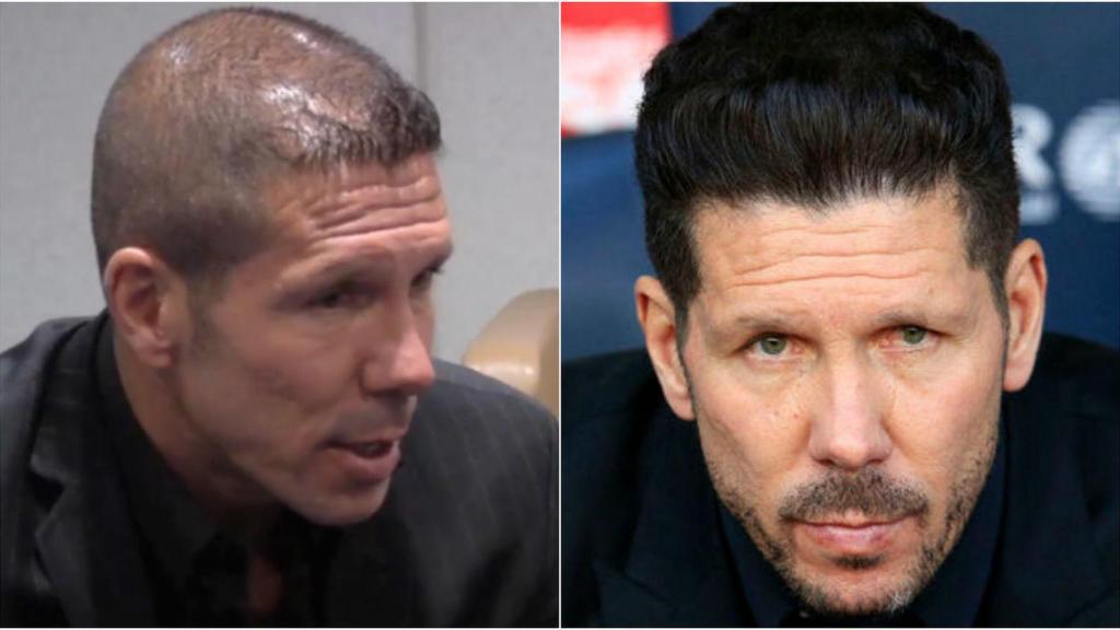 El 'Cholo' Simeone ha demostrado que de la calvicie también se sale.