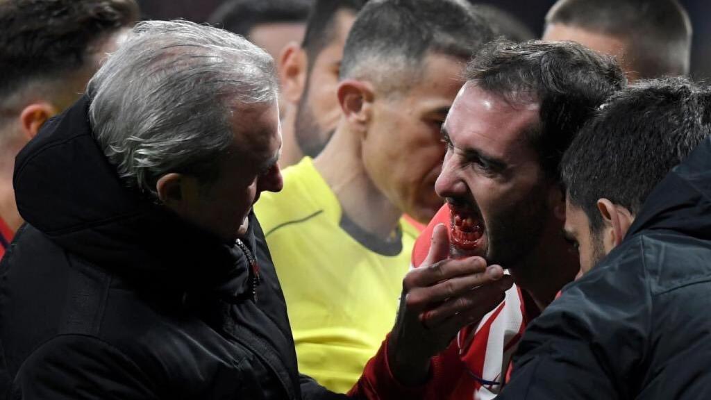 Godín, con sangre en su boca.