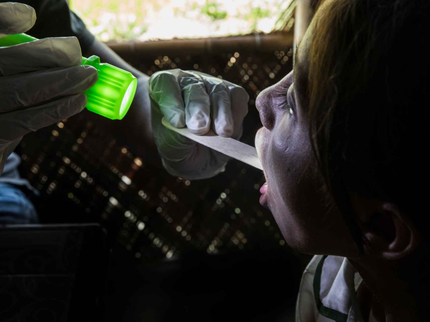 Difteria, una enfermedad de otro siglo que persigue a los refugiados rohinyá