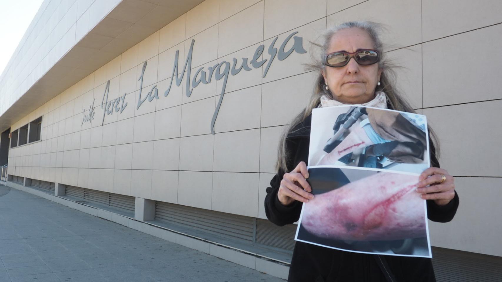 La tía de María del Carmen tiene inmóviles las piernas tras una rotura de pelvis.