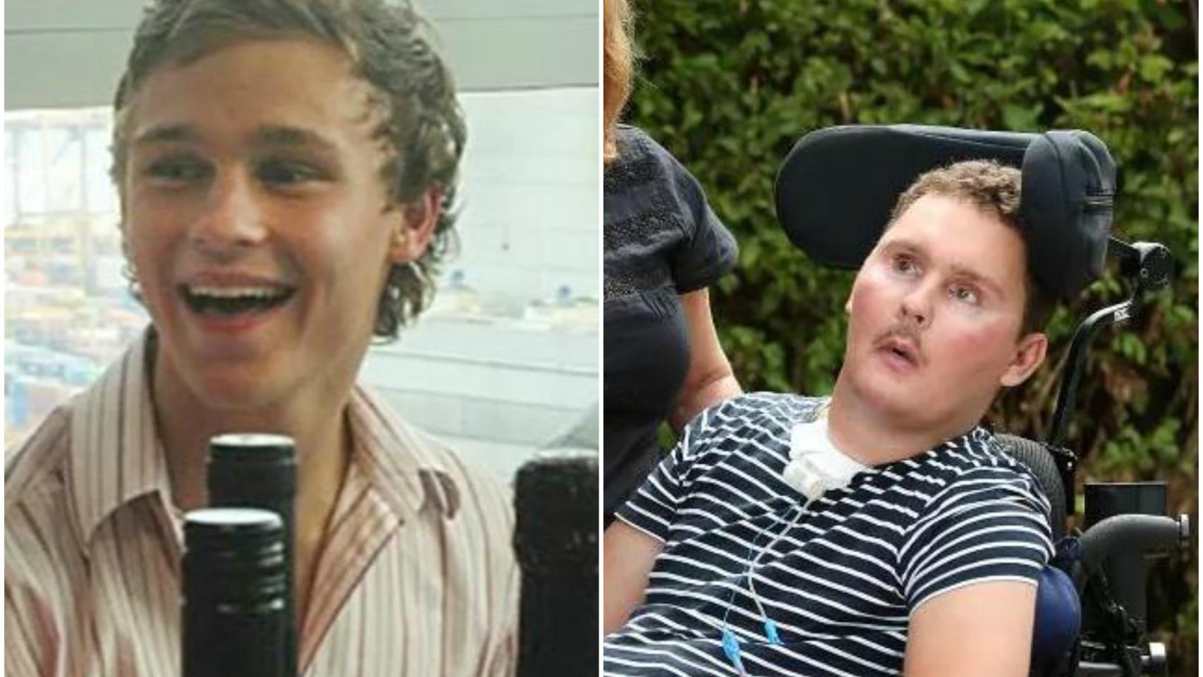 Sam Ballard, antes y después del accidente.