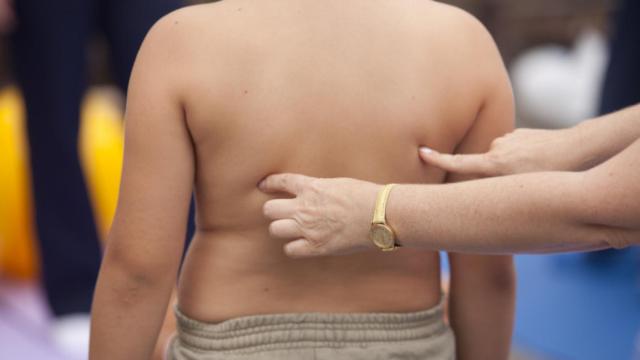 La obesidad infantil es un problema de salud pública.