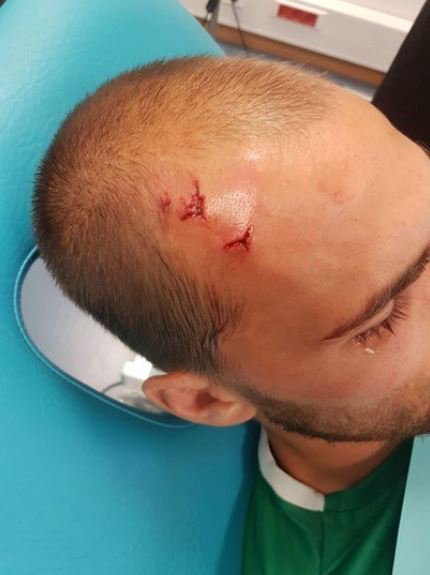 Bas Dost, herido en los incidentes con los ultras. Foto: Twitter (@chirichampions).