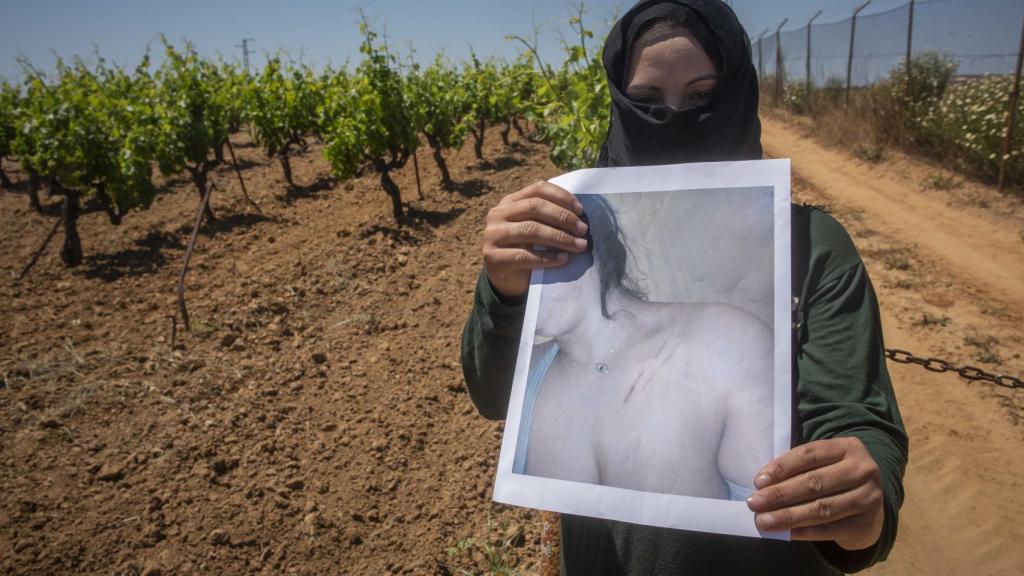 Laila denunció al hombre de 78 años que la sacó del campo a cambio casarse y mantener sexo con ella. Una vez le dio puñetazos y patadas. Cerca estuvo de violarla. Ella denunció. En la imagen, muestra las imágenes de las moraduras y cortes que le provocó.