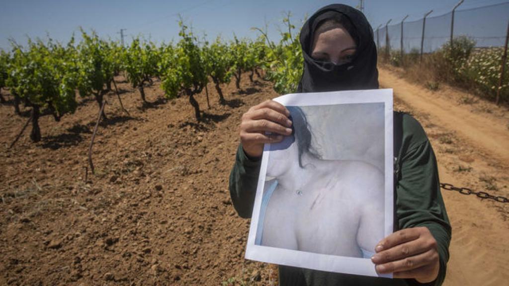 Laila denunció al hombre de 78 años que la sacó del campo a cambio casarse y mantener sexo con ella. Una vez le dio puñetazos y patadas. Cerca estuvo de violarla. Ella denunció. En la imagen, muestra las imágenes de las moraduras y cortes que le provocó.