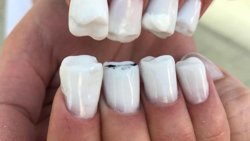 Uñas con forma de dientes en una imagen de las redes sociales.