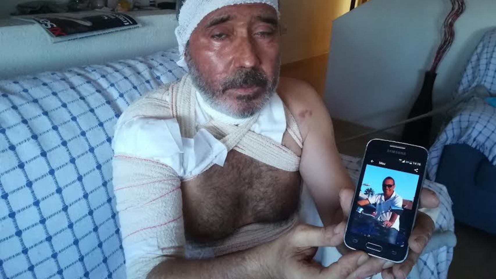José Antonio Romao se recupera en su casa de Archena (Murcia) de las severas quemaduras que le provocó su mujer al rociarle sosa cáustica por el cuerpo.
