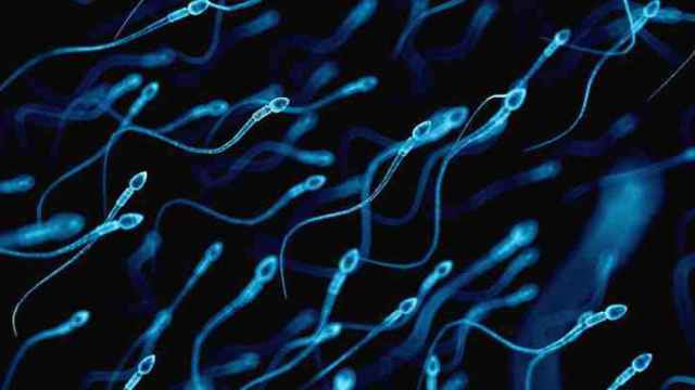 Un montón de espermatozoides luchando por colonizar un óvulo.
