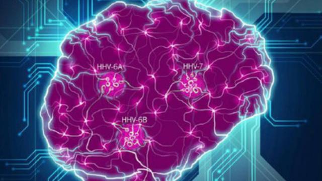 Las especies virales clave (HHV-6A, HHV-6B, HHV-7) interrumpen las conexiones neuronales.