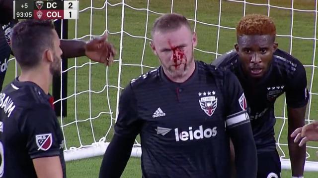 Wayne Rooney, con la nariz rota en un DC United - Colorado Rapids. Foto: mlssoccer.com