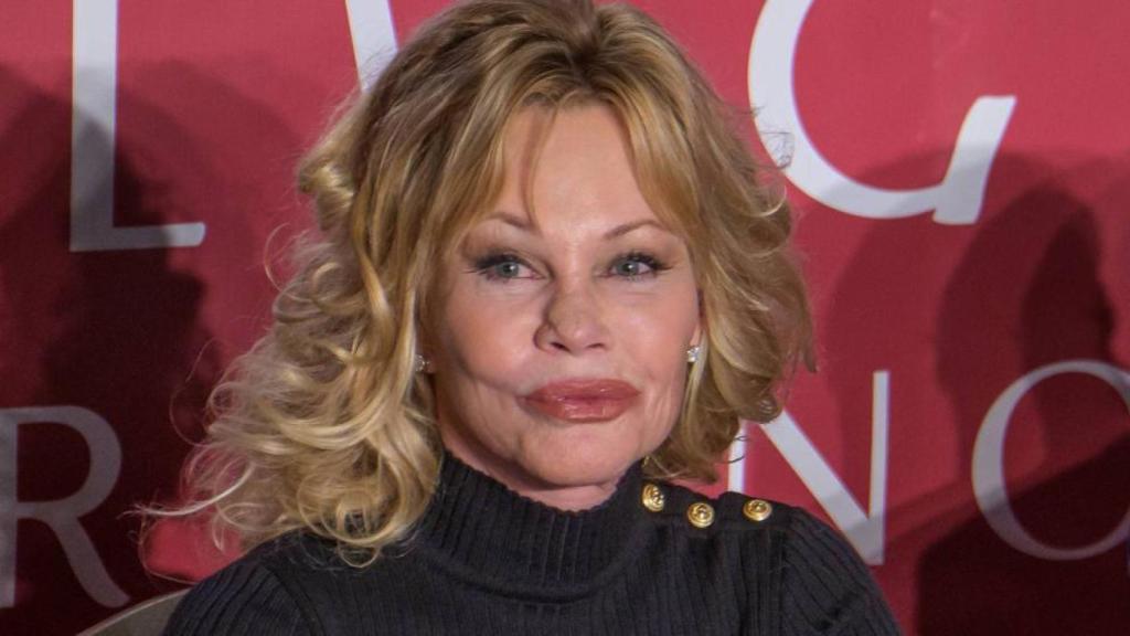 Melanie Griffith en una imagen después de su primera operación.