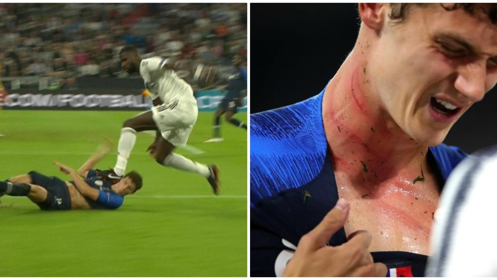 El lance entre Pavard y Rudiger y las consecuencias para el francés.