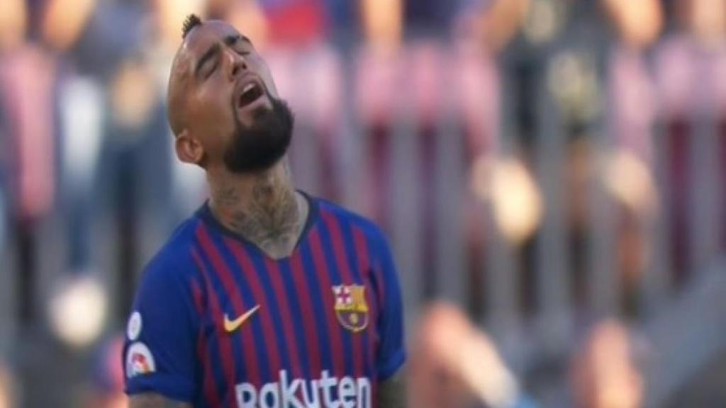 Arturo Vidal, con el gesto torcido.