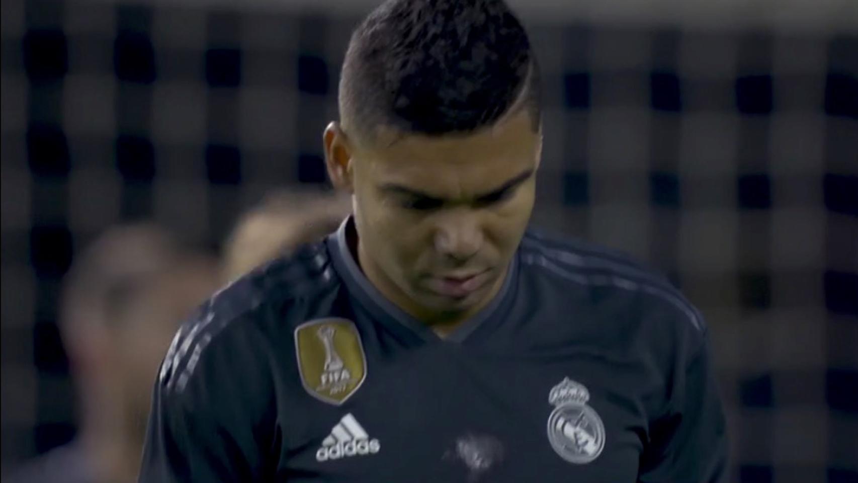 Casemiro se retira del campo lesionado