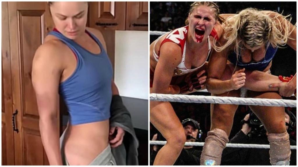 Ronda Rousey enseña las secuelas de la mayor paliza de su vida