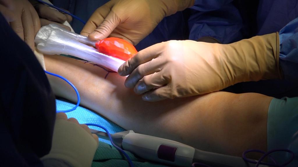 Una muestra del sistema desarrollado en el Hospital Gregorio Marañón.