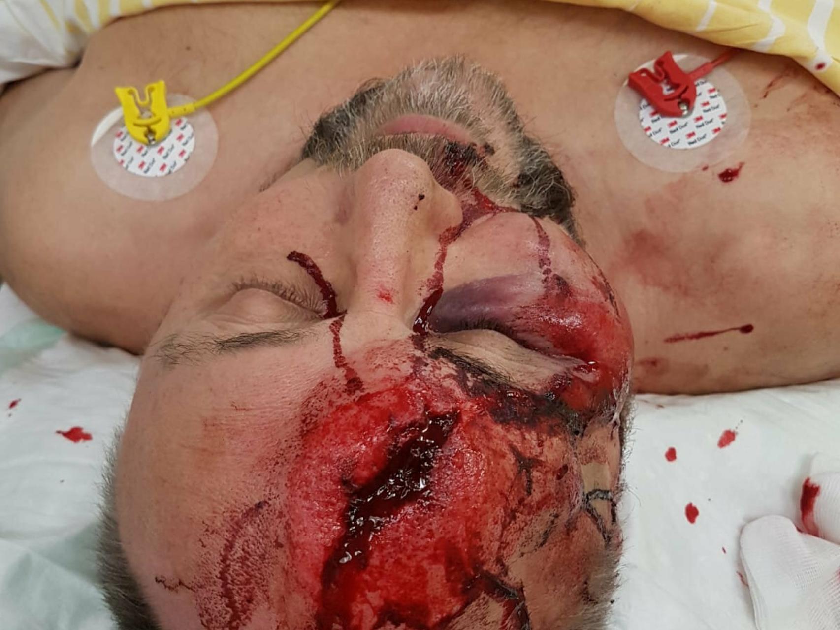 Así quedó Frank Madnitz tras el ataque.