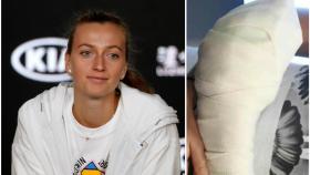 ¡Alerta, imagen explícita!: Kvitova revive su pesadilla cuando fue acuchillada