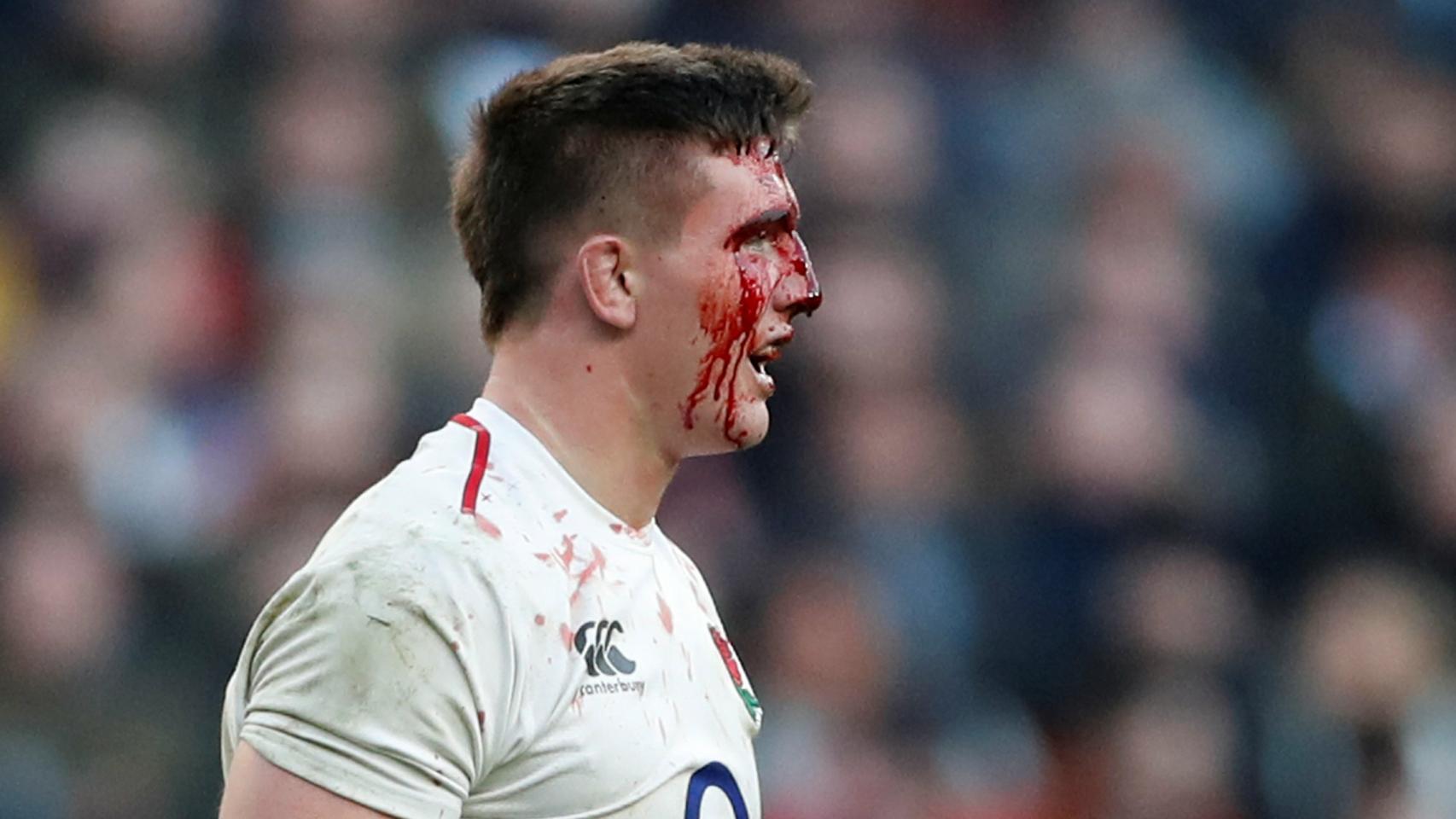 Tom Curry sangra por la cabeza en el Inglaterra - Francia