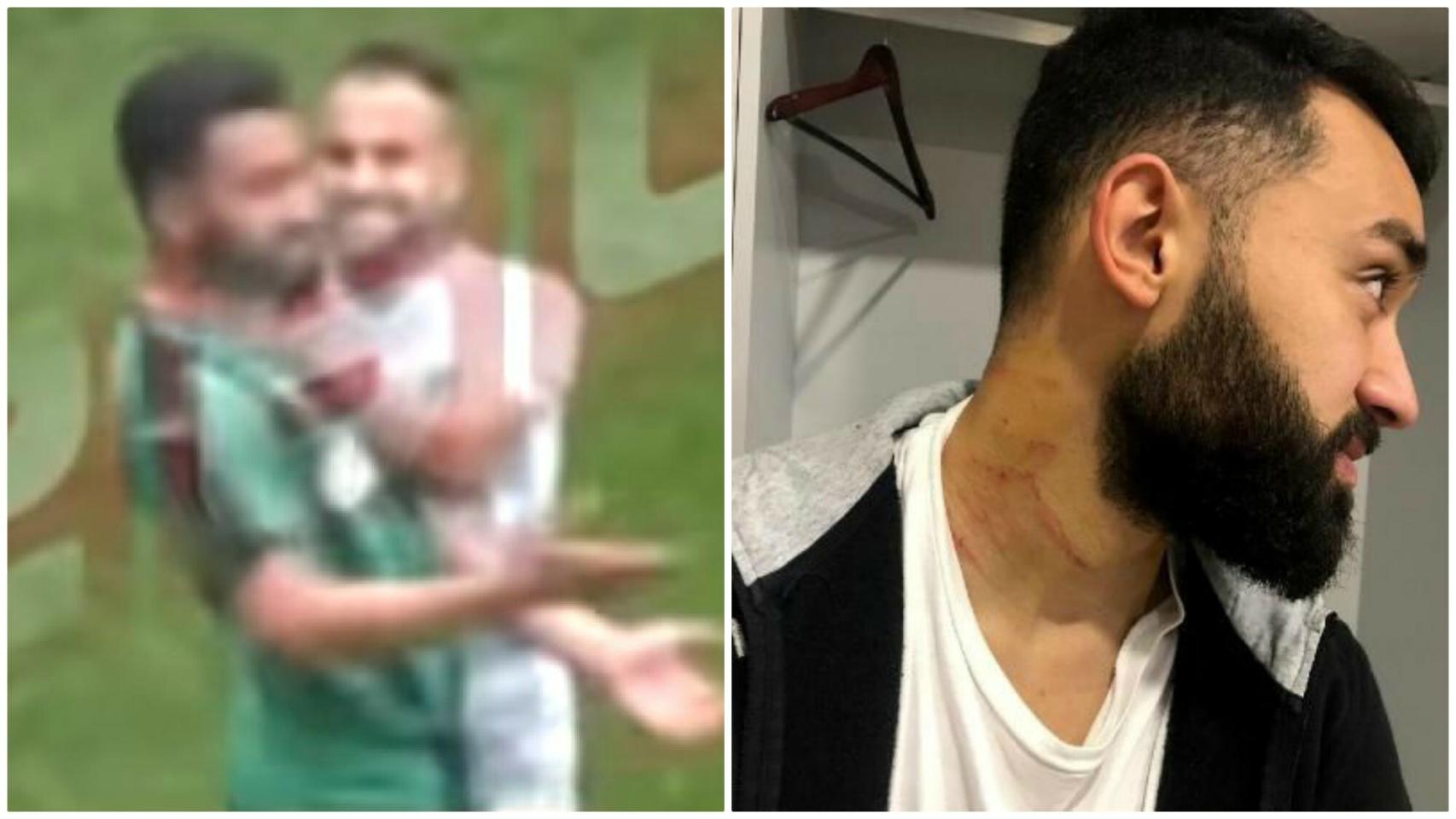 Un futbolista salta al campo con una cuchilla y raja a varios rivales