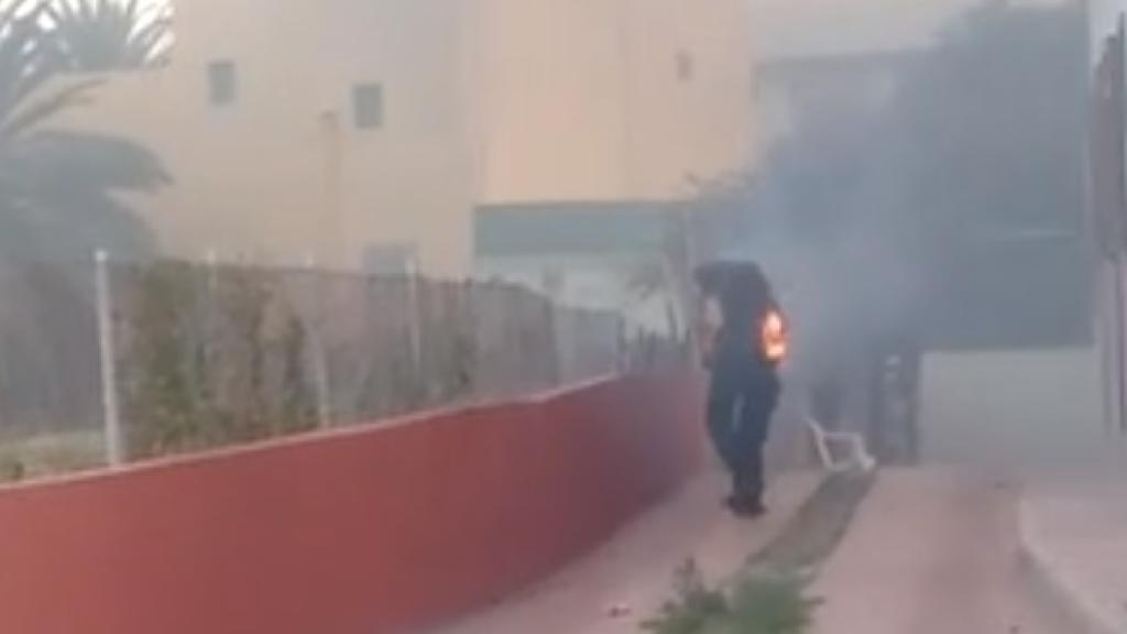 El hombre herido muy grave tras las quemaduras producidas en el incendio.