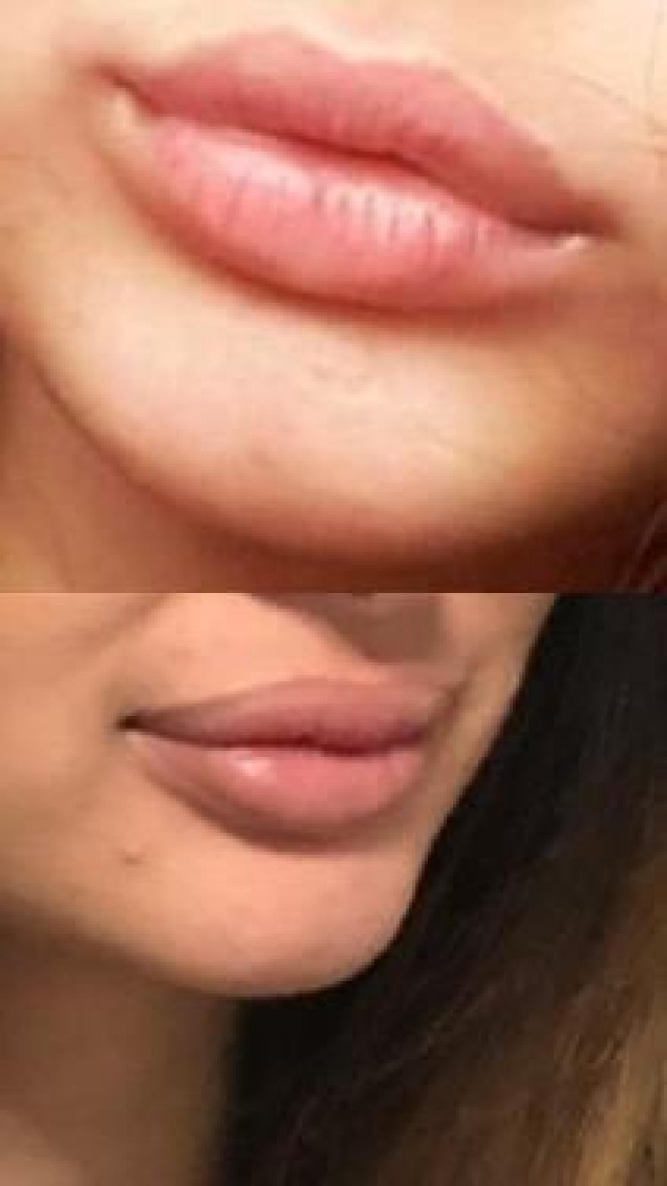 Labios de otra víctima de 'la falsa médica'