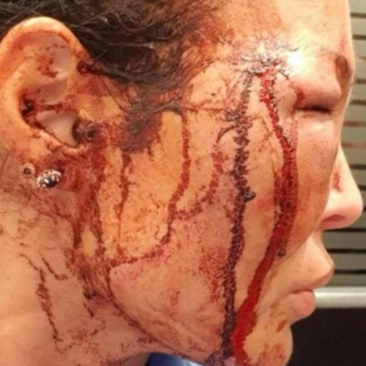 Manto Tzavaras cuelga en Facebook los resultados de la supuesta agresión