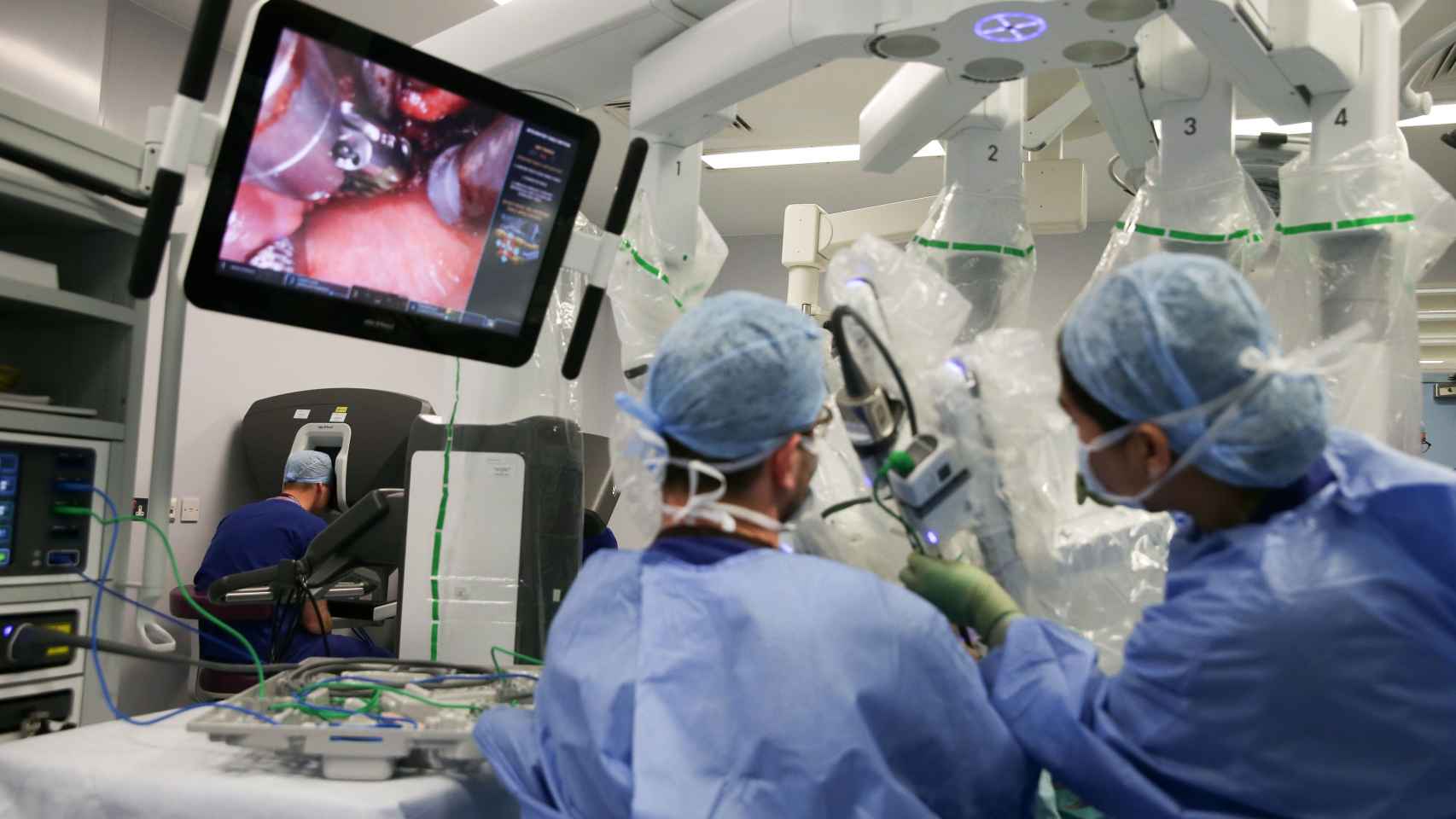 Una fotografía de una operación