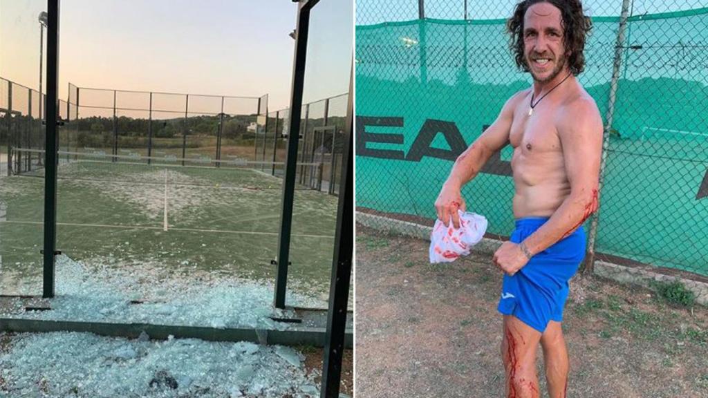 El accidente de Puyol mientras jugaba al pádel. Foto: Instagram (@carles5puyol)