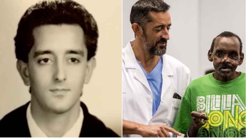 A la izquierda, Pedro Cavadas en su etapa universitaria; a la derecha, el cirujano presenta el rostro y la mano reconstruidos de Lonunuku en 2018.