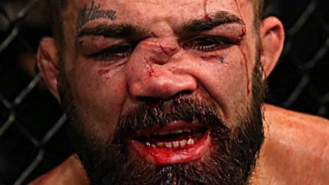 Mike Perry tras sufrir una patada en el combate contra Vicente Luque.