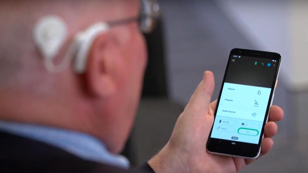 Implante coclear conectado a un smartphone.