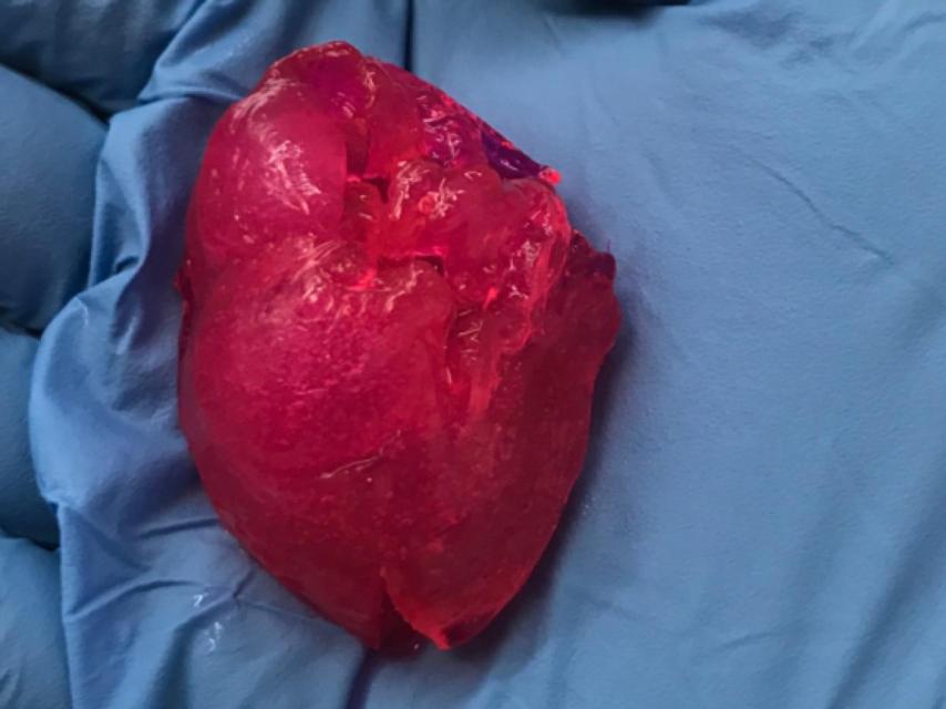 Corazón impreso en 3D