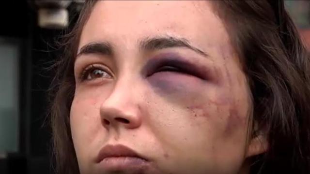 Los hechos sucedieron en la madrugada del pasado lunes.