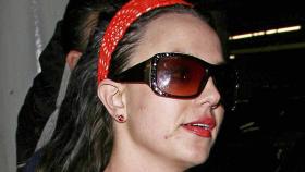 Britney Spears es una de las celebridades que ha tenidos que luchar contra el acné en su carrera.