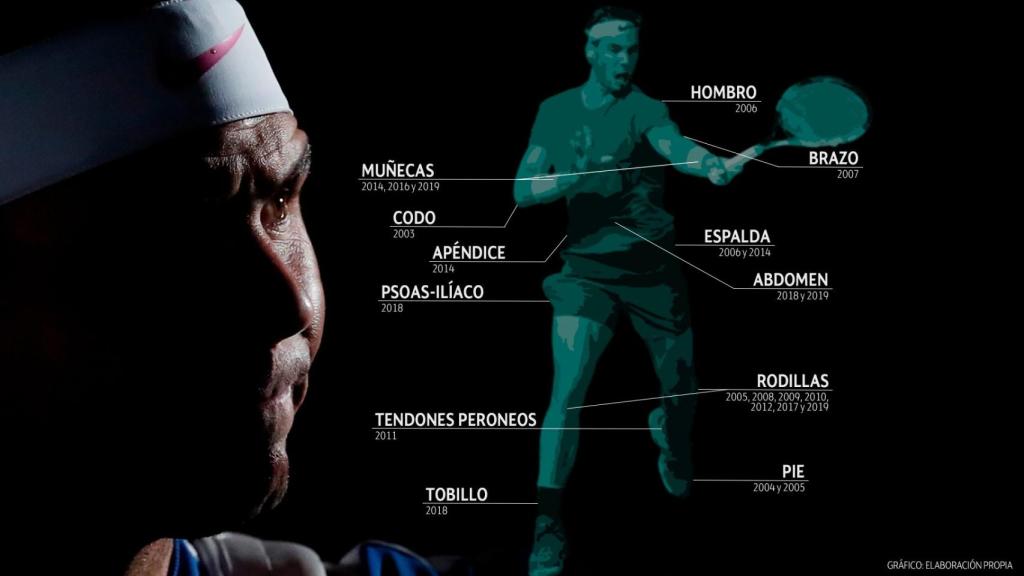 Las lesiones de Rafa Nadal