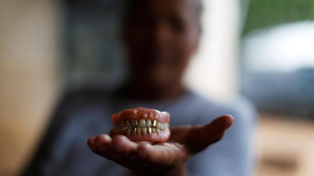 Dentadura postiza. JOSE CABEZAS/Thomson Reuters