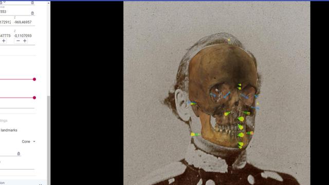 Así funciona Skeleton-ID, superponiendo el escáner craneal con las fotografías.