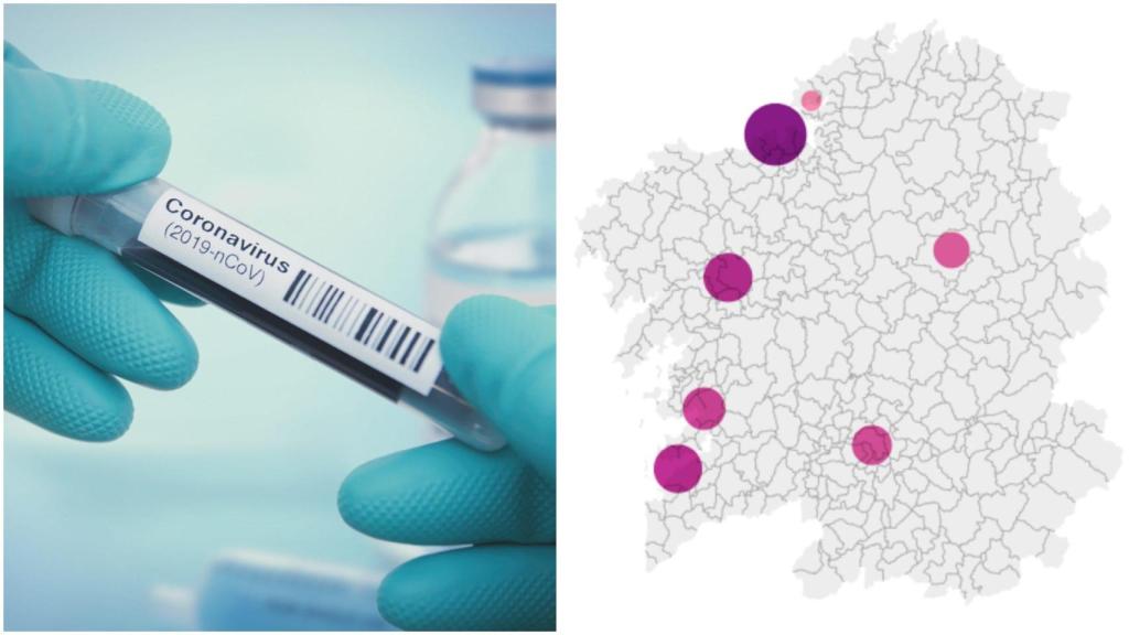 Galicia suma 341 infectados por coronavirus, 36 casos nuevos