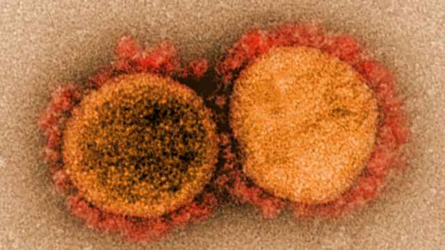 El coronavirus SARS-CoV-2. NIAID/Wikimedia Commons.