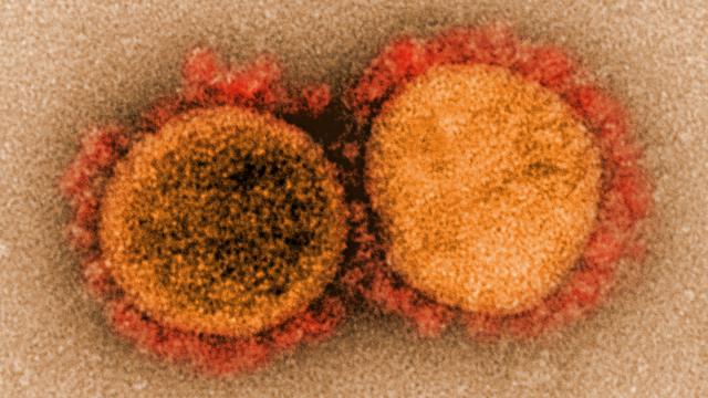 El coronavirus SARS-CoV-2.