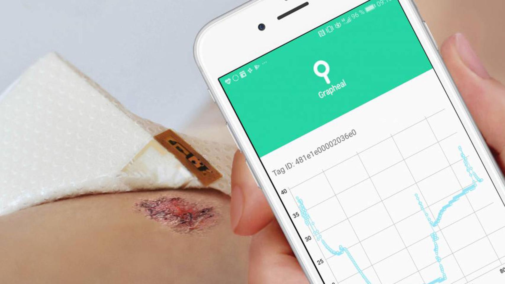 Los datos de la herida recogidos por el parche de grafeno se envían al hospital a través del móvil.