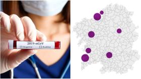 Coronavirus: Galicia suma 4842 contagios tras 410 nuevos casos positivos
