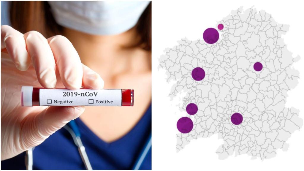 Coronavirus: 101 nuevos contagios en Galicia y 8185 casos positivos en total