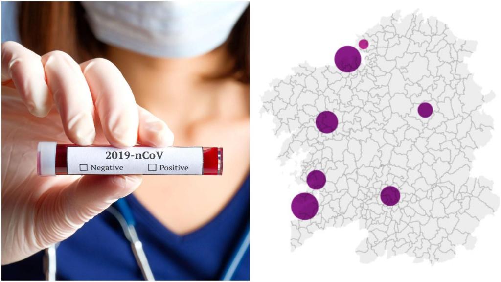Coronavirus: Suben a 184 los nuevos contagios en Galicia con 9116 casos positivos en total